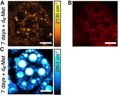 Imaging the uptake of deuterated methionine in Drosophila with stimulated Raman scattering